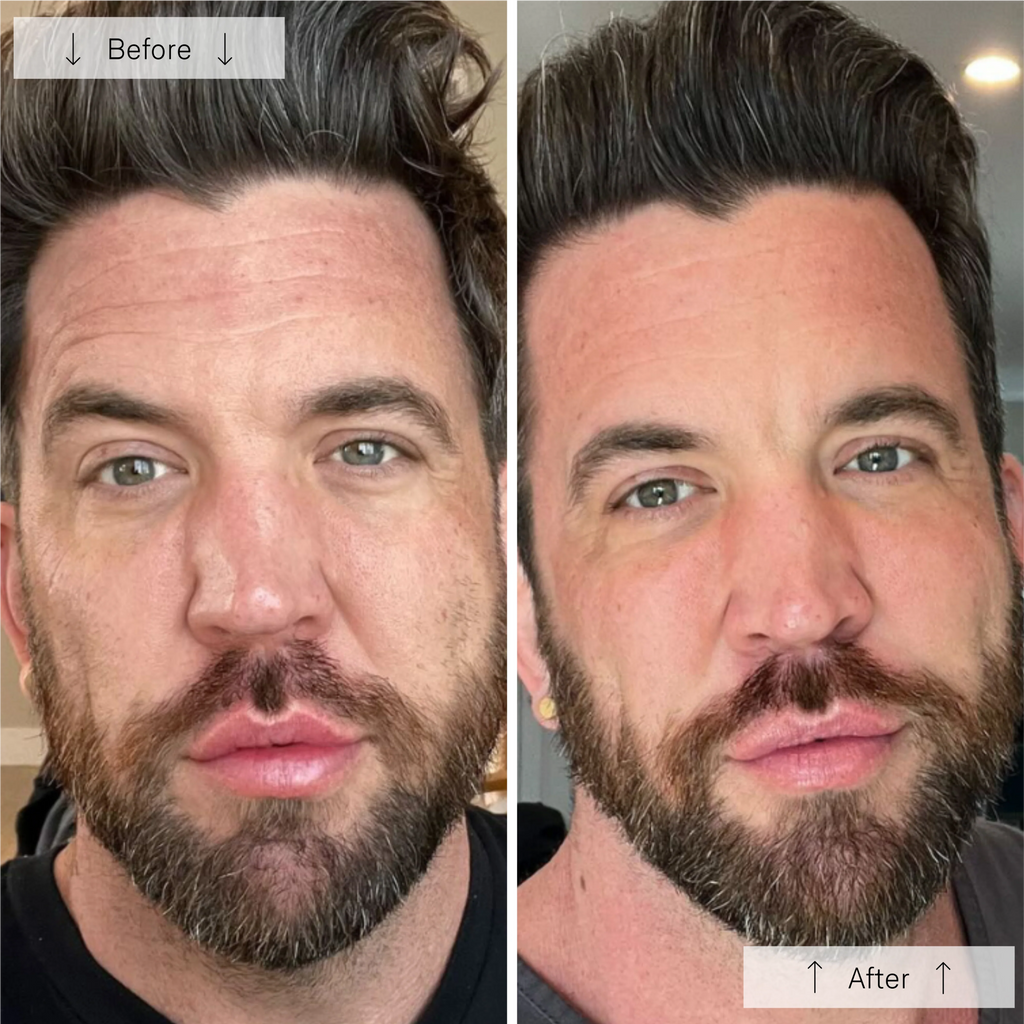 Omnilux Men